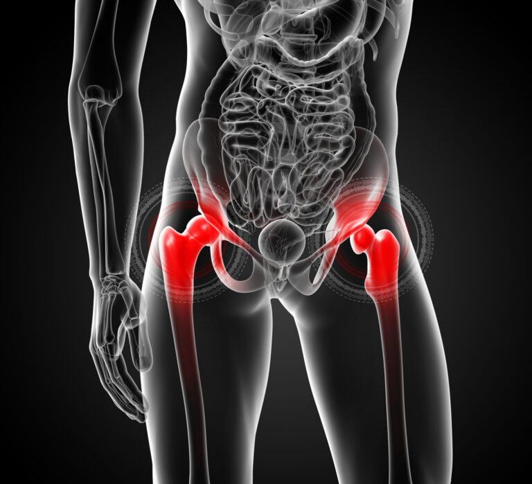 Osteopathy for Hip and Thigh Pain Arc Osteopathy
